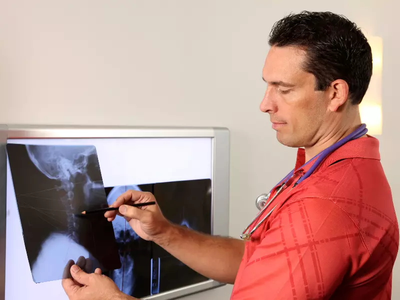 Posture Improvement Chiropractor in Newark, DE Near Me Posture X-rays