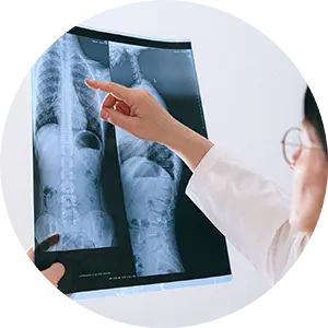 Scoliosis Conditions Treatment Chiropractor in Newark, DE